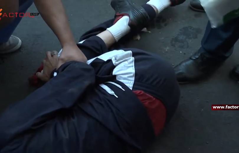 АРМЕНИЯ: Ногу гражданина, избитого сторонниками Кочаряна, прооперируют. Задержано три человека