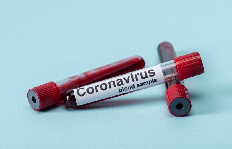 АРМЕНИЯ: В Армении за сутки выявили 146 новых случаев коронавируса